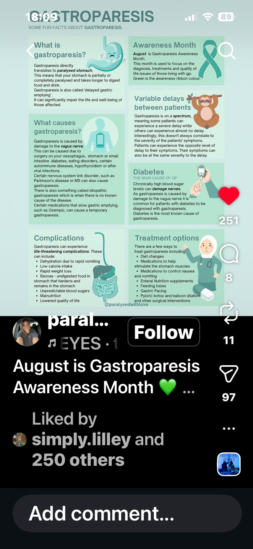 Infographic explaining what gastroparesis is, its causes, complications and treatment options
